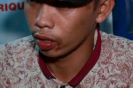 Lalaking gumamit ng tear gas sa sayawan, kinuyog