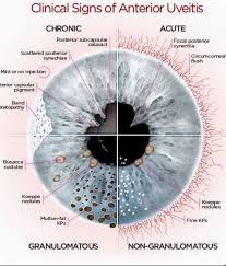 Image result for Ciliary Flush