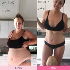Having loose skin around areas of the body such as the stomach, legs, arms or face is typically down to one of three reasons: Post Pregnancy Stretch Marks And Loose Skin What Can I Do About It