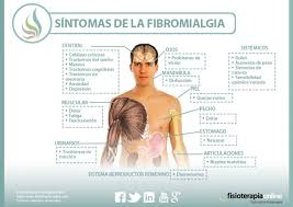 La mayoría de los tipos de tratamiento de la fibromialgia tienen como objetivo, ya sea controlar el dolor o mejorar el sueño. Fibromialgia Que Es Causas Sintomas Tratamiento Y Consejos Fisioonline