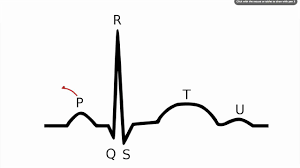 048 how to read an electrocardiogram ecg ekg