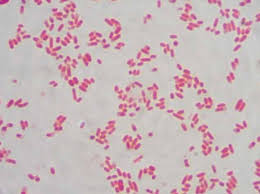 Natural habitats salmonella is ubiquitous in animal populations, and human illness is usually linked to foods of animal. E Coli Gram Stain Results Difference Between E Coli And Pseudomonas Aeruginosa