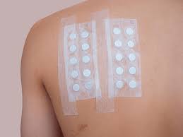 Image result for Patch Testing