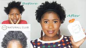 Like dry skin, dry hair has a wide spectrum of levels from mild to severe and a wide range of causes, as well. This Deep Conditioner Saved My Dry Brittle 4c Natural Hair Naturall Natural Hair Styles 4c Natural Hair Deep Conditioner
