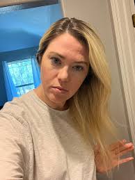 Meadow Skyy Aesthetics and Wellness Lip filler special this month. 1/2  syringe $350 and full $550. This month only $100 off full and $50 off half.  DM, text or call 936-333-7303