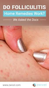 Folliculitis Is A Common Benign Skin Condition Caused By The Presence Of Inflammatory Cell Foliculitis Treatment Folliculitis Treatment Infected Hair Follicle