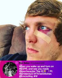 Lesson learned for Ron Baker after he tried to block Anthony Davis 🤕