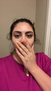 Nurse Jackie Rash After Ireland Flight Rash