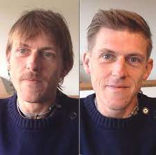 Men S Short Haircut For Thinning Hair Haircuts For Balding Men Thin Hair Men Hair Loss Men
