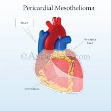 It is estimated that each year 2,000 new cases of mesothelioma are diagnosed. Mesothelioma Medical Terminology Wild Country Fine Arts