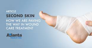 Caring and compassionate diabetic foot treatment in macomb county, mi. Second Skin How Atlanta Medical Clinic Is Paving The Way In Diabetic Wound Care Treatment Atlanta Medical Clinic