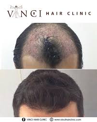Another Happy Client V 2020 G