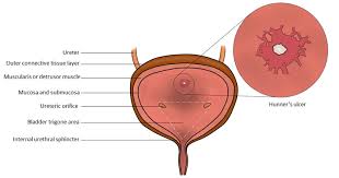 Image result for Bladder Anatomy