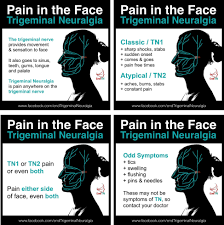 Pin By Fairytale Studios On Health Trigeminal Neuralgia Symptoms Trigeminal Neuralgia Neuralgia