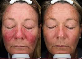 Dr Nina Wines Medical & Laser Dermatologist Sydney