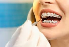 You won't need anything very large. The Scoop About Suresmile And If It S Right For You Woodhill Dental