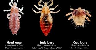 Image result for lice vs nits