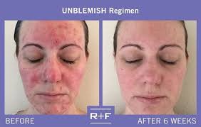 Sara Fredlund (@sarafredfred)