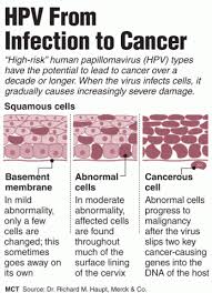Here, ob/gyns explain how long hpv can stay in your system. Hpv