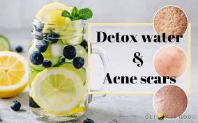 What is a good detox drink. Best Detox Water For Acne Scars Why They Work