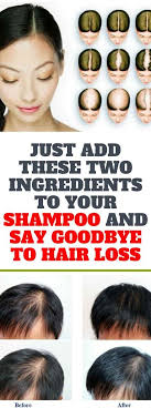 Do You Know What Causes Hair Loss The Experts Say That Hair Loss Is Related To Various Factors As What Causes Hair Loss Natural Hair Loss Treatment Hair Loss