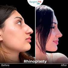 Did Hailey Bieber Have Plastic Surgery?