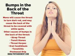 What Are The Causes Of Bumps In The Back Of The Throat Www Porthuronent Com Ent Entclinic Healthcare Tickle In Throat Dry Throat Remedy Throat Irritation