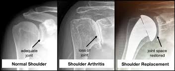 These are very simple tests with no preparation and should. Dr Julia Lee S Blog Sierra Pacific Orthopedics