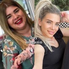 İnsanlar yıllar içinde değişiyor, yüz hatları oturuyor. O Xrhsths Baymagazin Evdekal Sto Twitter Sihirli Annem In Tugce Si Damla Ersubasi Nin Degisimi Damlaersubasi Sihirliannem Degisim Oncesisonrasi Estetik Magazin Https T Co C7cpfbmpqw