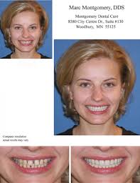 | a+ medical care | aaron feinstein, md, inc. Predictably In Meeting Patient S Expectations For Esthetic Dentistry
