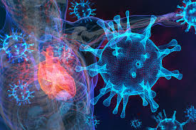 Symptoms can include shortness of breath, chest pain, decreased ability to exercise, and an irregular heartbeat. Feature Management Of The Hospitalized Covid 19 Patient With Acute Cardiomyopathy Or Heart Failure American College Of Cardiology
