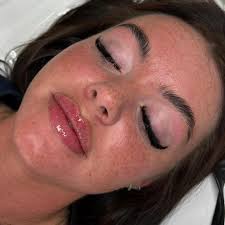 Enhancing lips isn't about chasing size, it's about balance, symmetry &  harmony with your natural features. A skilled injector doesn't just fill  lips. They sculpt, refine & tailor results to you. 👄✨