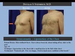 Pin On Plastic Surgery Videos