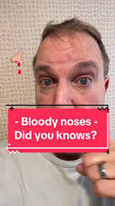 Quick home remedy for Nosebleeds #nosebleed #nose #mom #kids