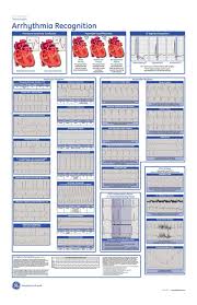 Arrhythmia Recognition Poster They Have A Huge One On My