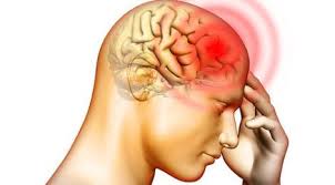 Non Invasive Vagus Nerve Stimulation Reduces Frequency Of Migranes Medical Design And Outsourcing Heal Leaky Gut Getting Rid Of Headaches Headache