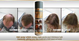 Virtual Hair Hair Spray Which Cover Bald Spots Virtual Hair