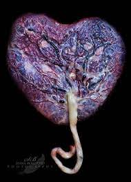 Pin On Placentas Trees Of Life
