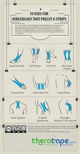 Pin On Kinesiology Taping Infographics