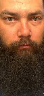 What could be causing my car's coolant to rise to H?