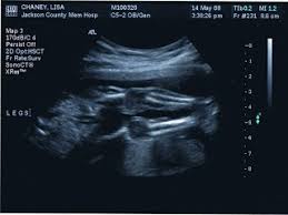 Basically This Is It Ultrasound