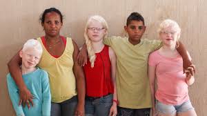 We did not find results for: My Albino Children Black Brazilian Family Have Three White Skinned Children Youtube
