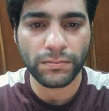 ملك ملوك التعرصة