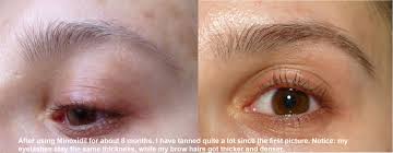 The hair growth cycle for eyebrows takes about four months total. Rogaine Minoxidil For Eyebrow Growth Reviews Makeupalley
