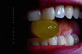 Pin On General Dentistry