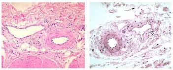 Veins are vessels that return blood to the heart. Vessel Comparison Bioninja