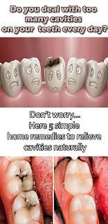 Top 5 Effective Home Remedies To Get Rid Of Tooth Decay Tooth Cavity Tooth Cavity Tooth Decay Home Remedies