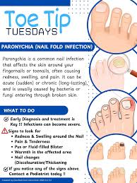 Image result for Paronychia feet