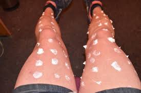 As we mentioned, how to prevent itching after shaving pubes mainly depends on the cause of irritation. Why Are My Legs Itching After I Shave Them Quora