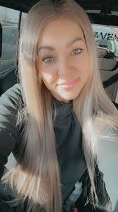 I was currently diagnosed with alopecia (mild as of now) having the gastric  sleeve